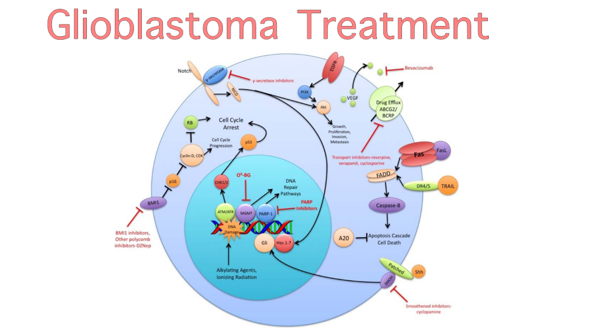 Glioblastoma Treatment IMC Grupo