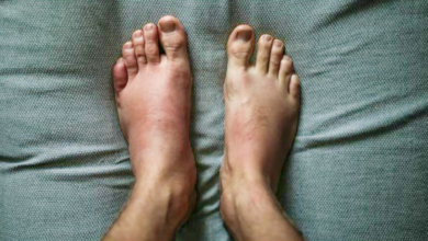 What to Know about Foot Injuries - IMC Grupo