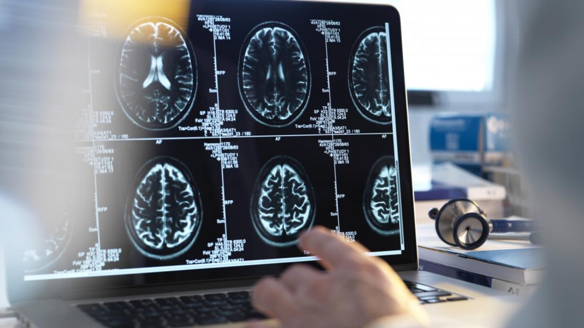 Know About The Problems And Solutions Of Encephalopathy - Imc Grupo