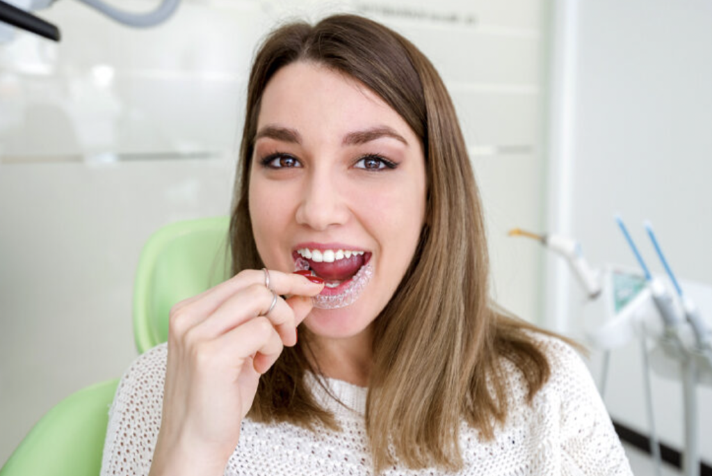 Advantages of Clear Aligners Over Braces